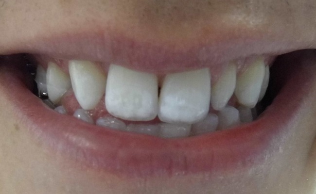 Before