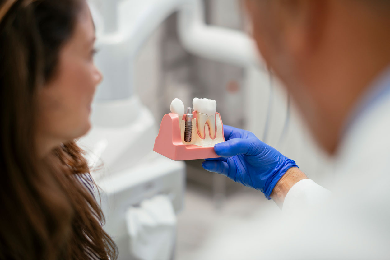 dental implants quicklink